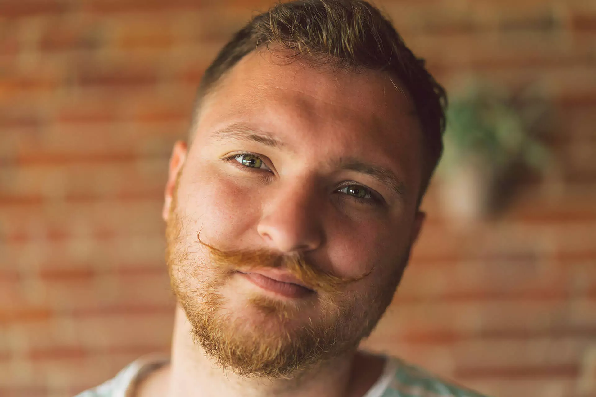 beard-and-mustache-transplant