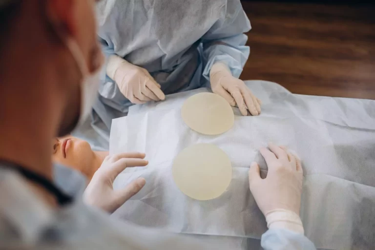 breast-augmentation