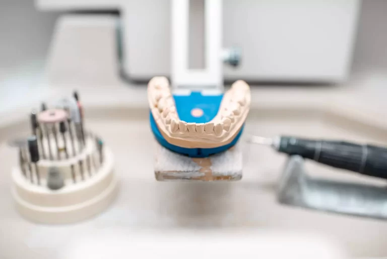 dental-prostheses