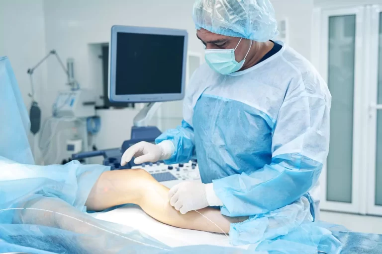varicose-veins-treatment