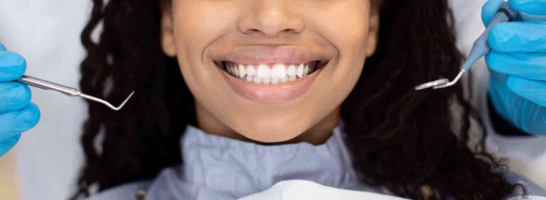 smile-makeover