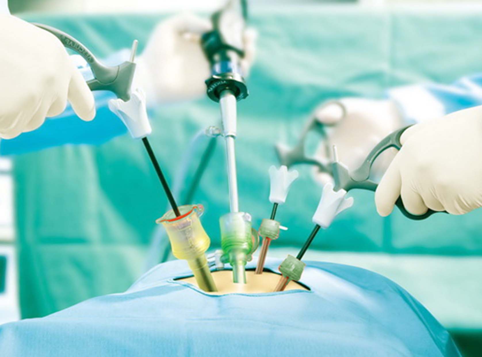 advanced-laparoscopic-surgery-2