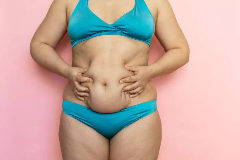 tummy-tuck